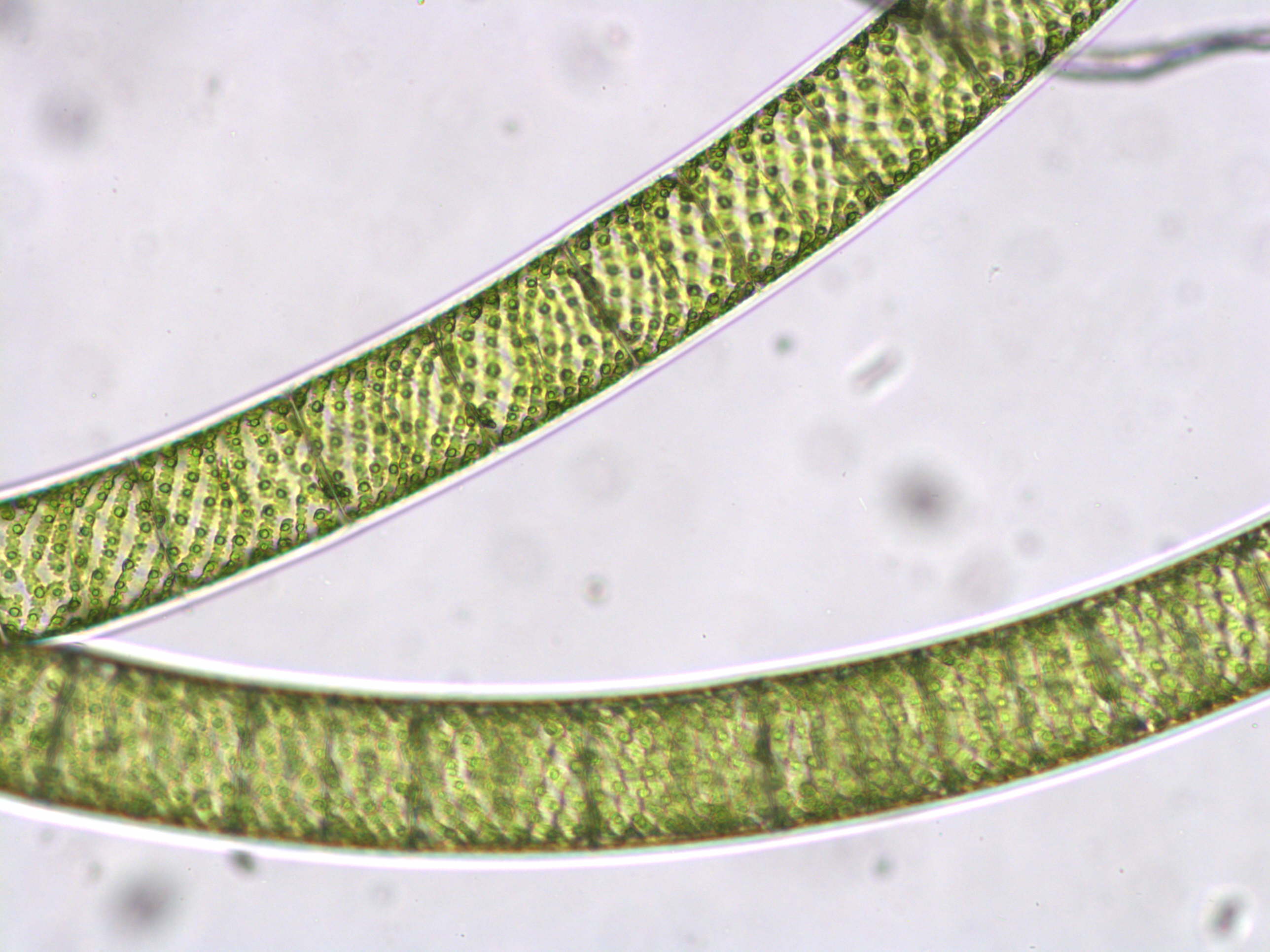 Vue au miscroscope de microalgues filamenteuses